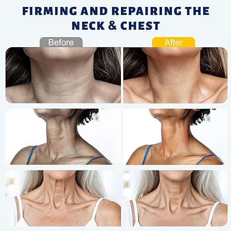 LiftRoll Pro Collagen Sculpting Neck Cream 🧴