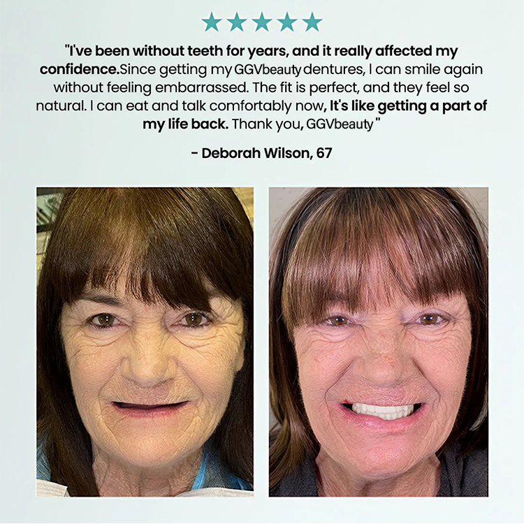 Fit Full Functional Dentures Make You More Confident